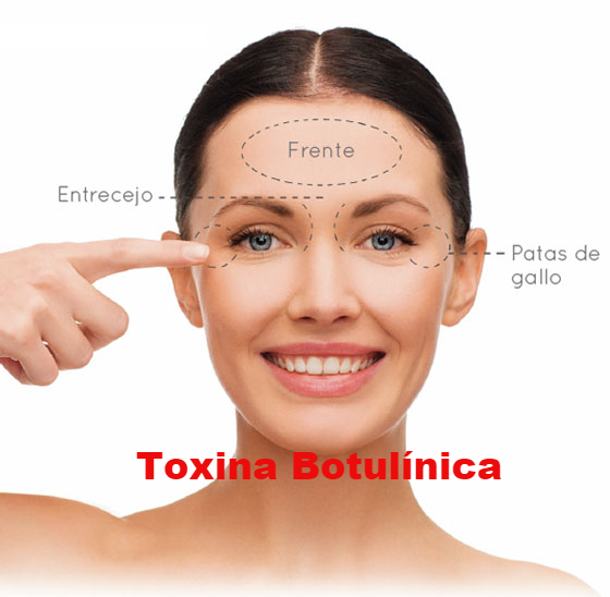 botox metepec, botox toluca, dermatología, acné