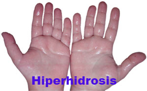 hiperhidrosis